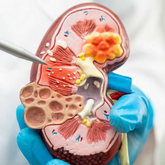 litotricia-extracorporea EN QUITO